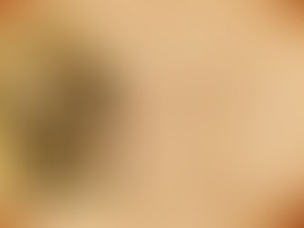 CO SE DĚJE NA OBLOZE?