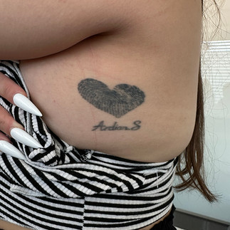 Tattooentfernung in Dübendorf – Zürich