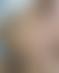 Tattooentfernung ohne Narben