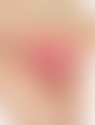 Flora Vaginal, a importância dos cuidados diários