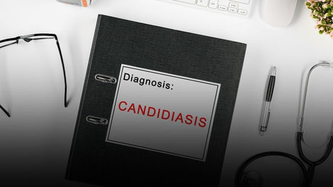 Candidíase de Repetição: Quando o Problema Não Está Apenas no Corpo, Mas Também no Estresse Que Você Carrega