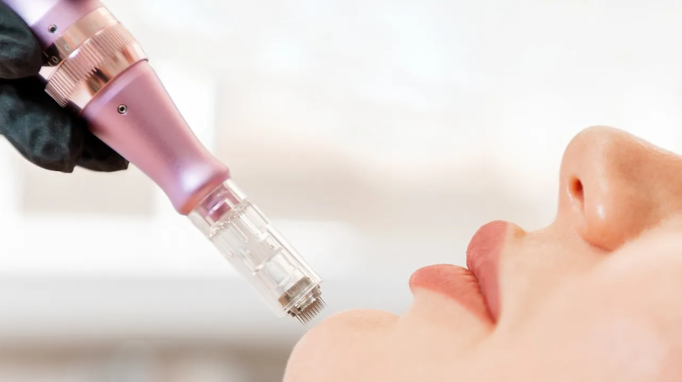 MN needles.png