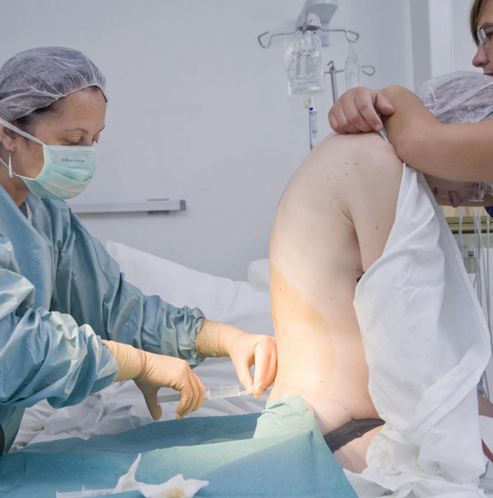 An epidural involves placing a small tube (catheter) into the lower back, in the space around the spinal cord (called the epidural space). Through this tube, medication is given to numb the nerves that carry pain signals from the uterus and birth canal. credit photo babycentre.ca