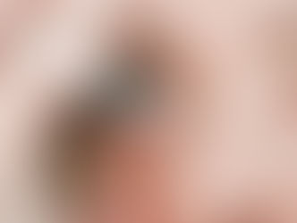 Oogdruppels tegen droge ogen