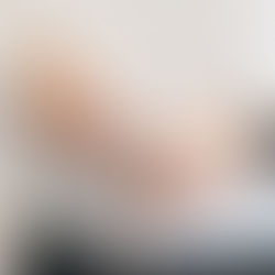 Wat zijn accommodatie-ondersteunende glazen?