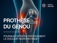 Prothèse du genou : Pourquoi dépister précocement la douleur neuropathique ?