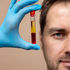PRP Injection Preparation and Aftercare Guide from ACTIVATE in London & Kent