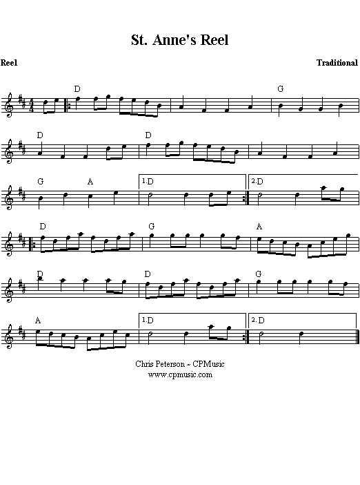 St. Anne's Reel