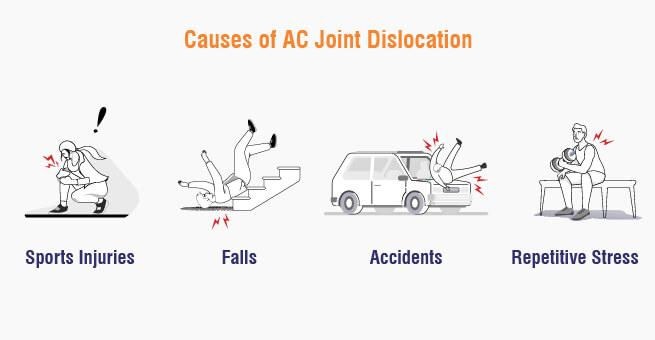 Modes of AC joint injury