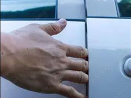 When the Door Slams: Managing Hand and Finger Injuries on the Job