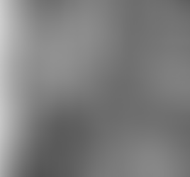 Cryotherapy Applications in Preventing and Treating Osteoporosis