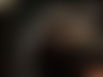 Hair Transplant Cost in Turkey 2026: Full Price Guide + Clinic Comparison