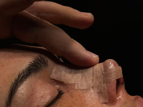 Is Turkey Still the Best Country for Rhinoplasty in 2026?