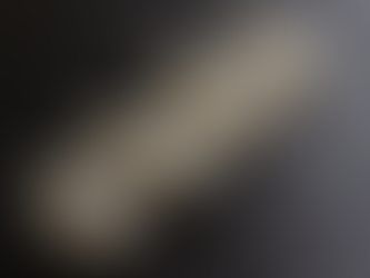 What are Composite Veneers?