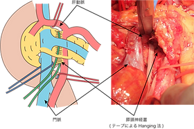 肝臓・胆道・膵臓疾患について | 昭和医科大学藤が丘病院 消化器・一般外科