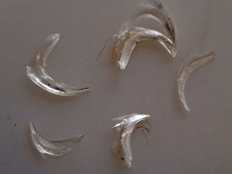 Are the limits of one's world, the limits of one's world?