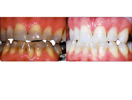 Add a subheading_edited_edited.png