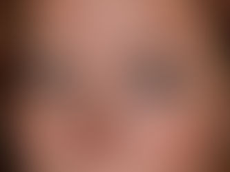 Best Solution for Thinning Eyebrows, Sparse Brows, Overplucked Brows, or No Eyebrows at All ✨