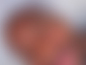 🚹 The Ultimate Guide to Men’s Brow Restoration: From Transplants to Nano Brows