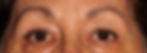 before01.jpg