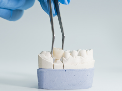 DENTAL CROWN.png