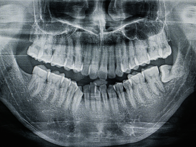 DC X-RAY.png