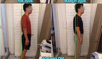posture correction