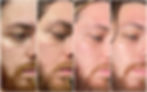 antes e depois resultados positivos dos produtos cosméticos da principia skincare skin