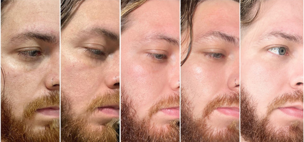 antes e depois resultados positivos dos produtos cosméticos da principia skincare skin
