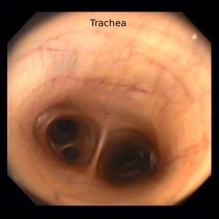 Horse trachea shows inflammation from heaves
