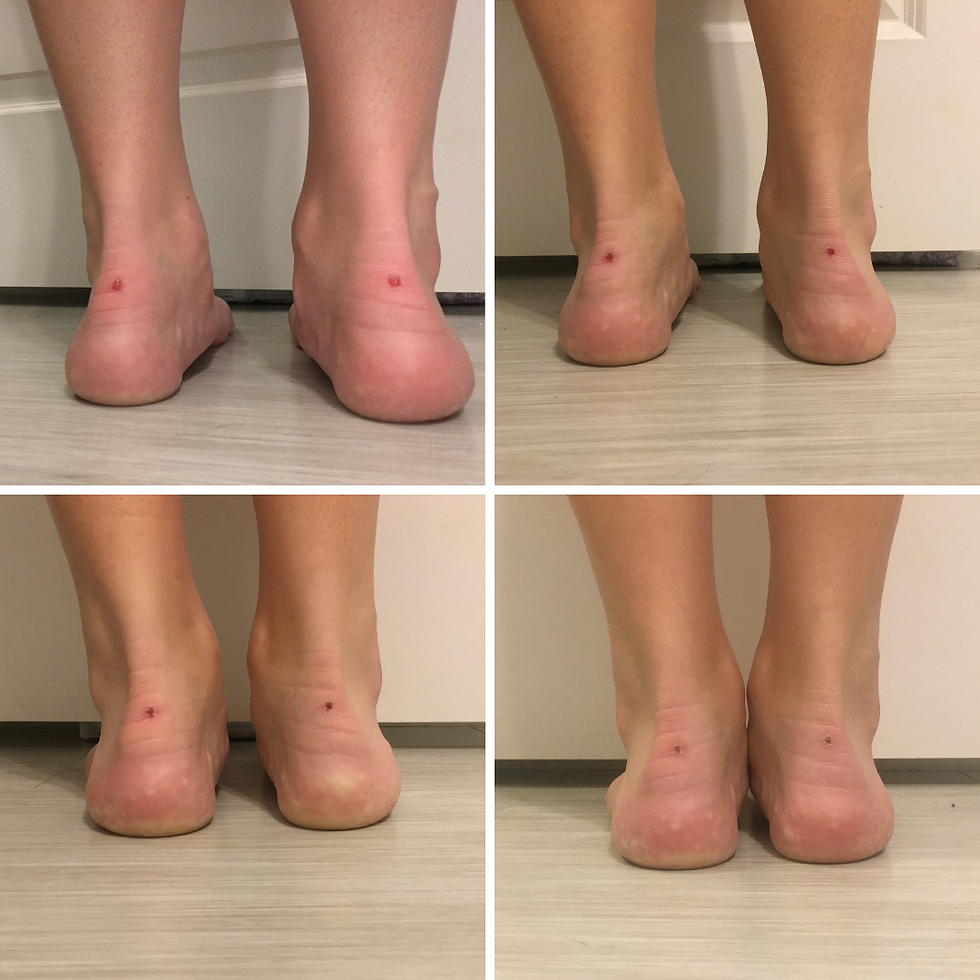 red light therapy healing comparison on a human
