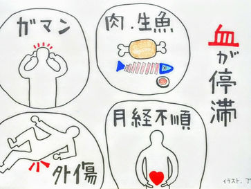 【更年期障害と東洋医学②】鍼灸院/鍼灸ゆーせん/大阪府八尾市上尾町