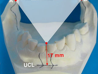 An Analysis of the Staub Cranial System