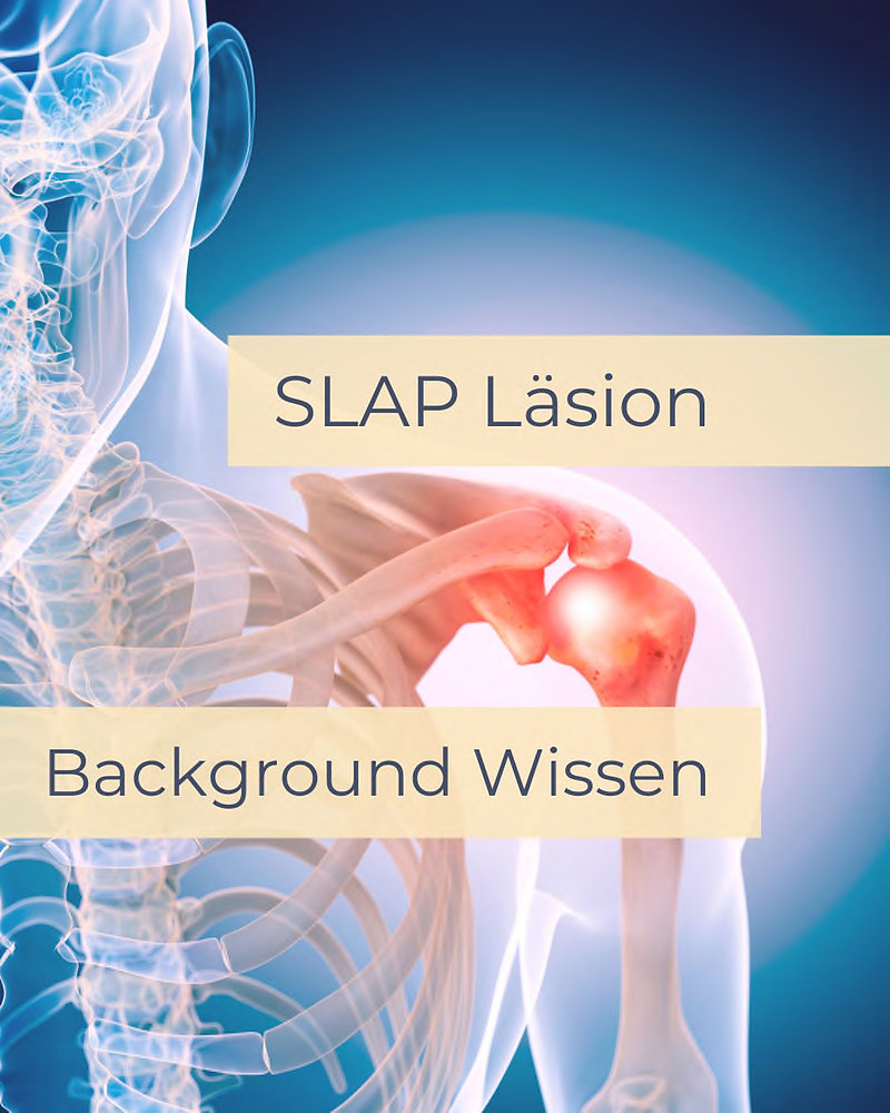 SLAP Läsion Was ist das? Was kann man dagegen machen? Operation und Physio