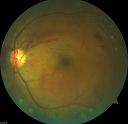 Retinal Associates of Oklahoma
