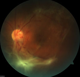 Retinal Associates of Oklahoma