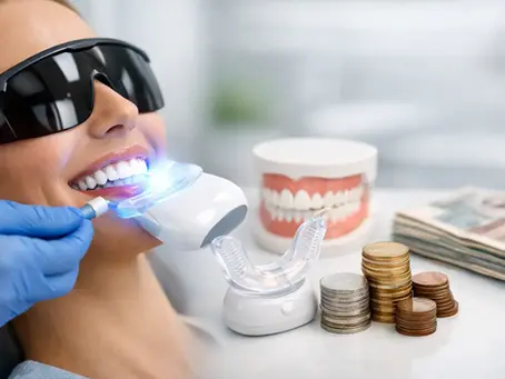 Teeth Whitening Cost: What You Can Expect