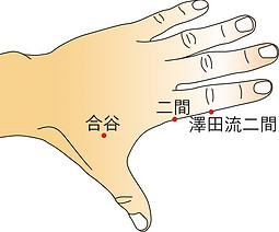 ものもらい2.jpg