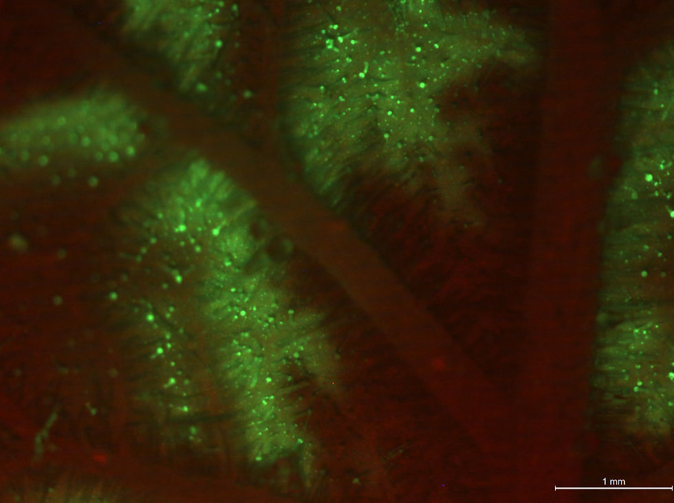 TEV-GFP