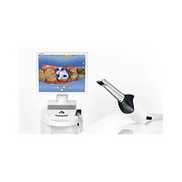 escaner intra oral