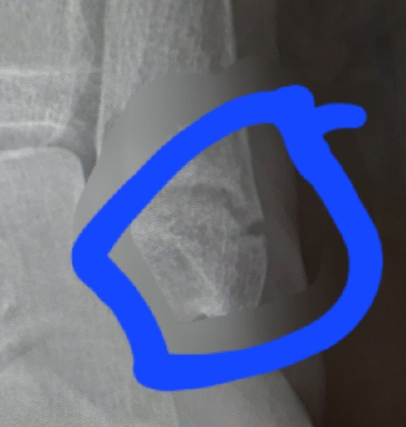 last xray 10/13