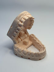 Articolatore Digitale Stampa 3D