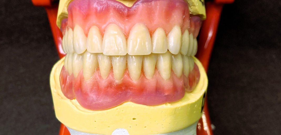 Protesi/ dentiere totali - Laboratorio Odontotecnico Imperia - Ortoodontika