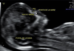 Imagen 6.jpg