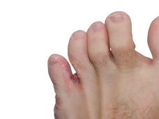 AdobeStock_45042844.jpeg