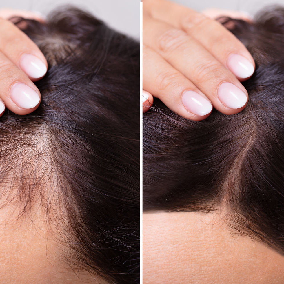 Hair Loss Treatments & Solutions for Thinning Hair