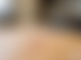 An Essential Guide to Dry Needling Treatment