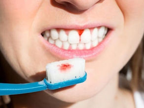 Sonríes, pero tus encías llaman la atención