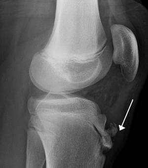 OSGOOD SCHLATTER