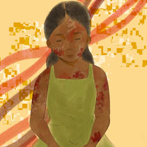 Toward Stronger Skin: New Frontiers in Epidermolysis Bullosa (EB) Treatment